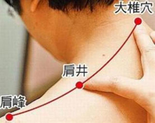 肩井穴位于肩上,前直乳中,当大椎与肩峰端连线的中点,即乳头正上方与