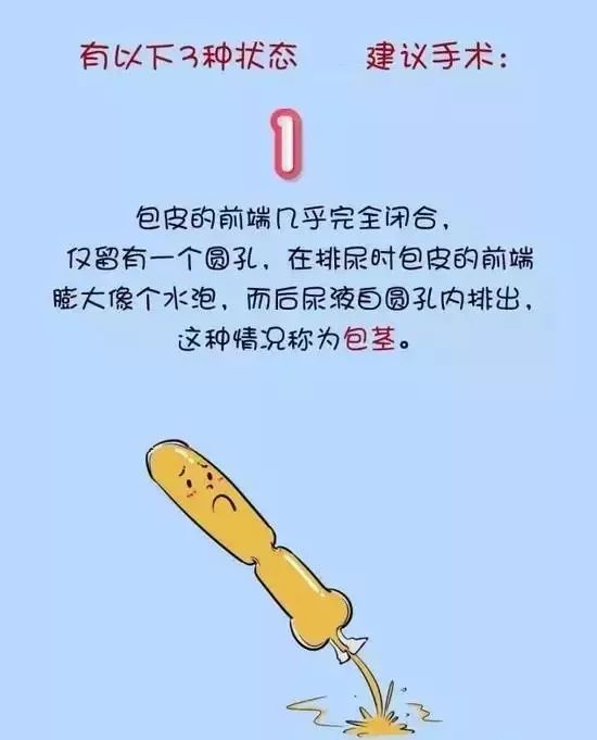 包皮是个好东西有这3个情况就要割