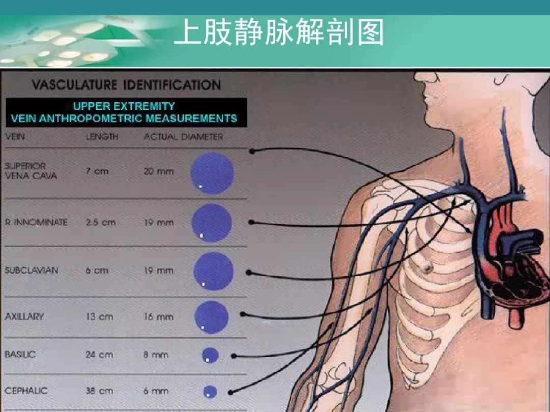 picc置管详细流程及维护步骤,超实用!