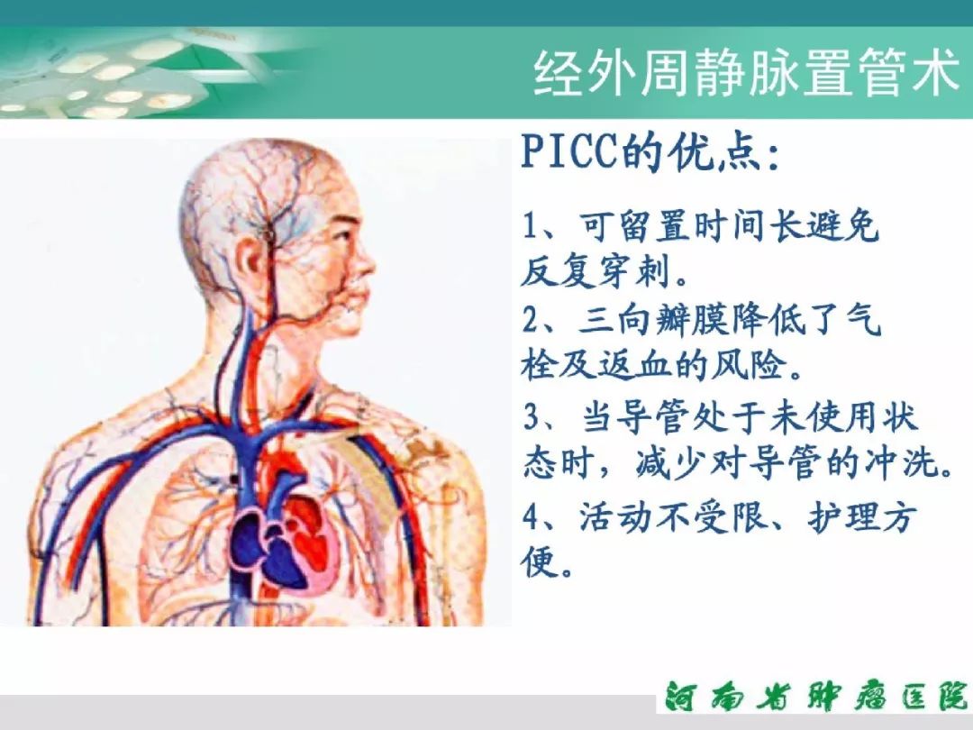 picc置管详细流程及维护步骤,超实用!