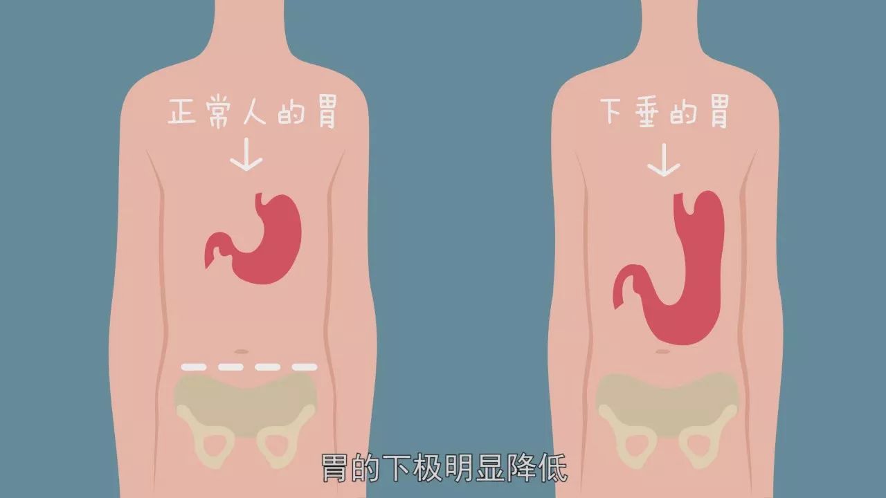 饭后百步走会得胃下垂?说好的活到99呢!