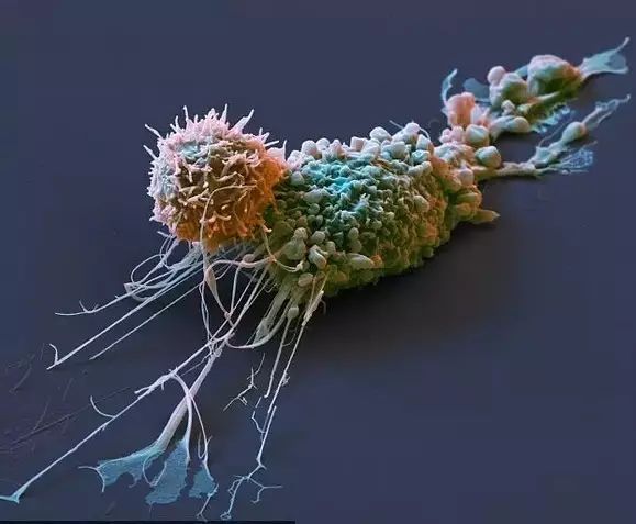 美图 看免疫细胞大战癌细胞