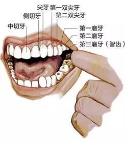 【口腔】有智齿的人都经历过智齿的疼,你还在纠结拔不拔吗?