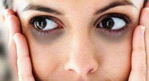 防止黑眼圈的产生,除了别熬夜,还有这4种方法也可以试