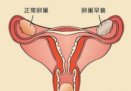 卵巢位于下腹部的盆腔内子宫的两侧 左右各一,以韧带与子宫相连 是