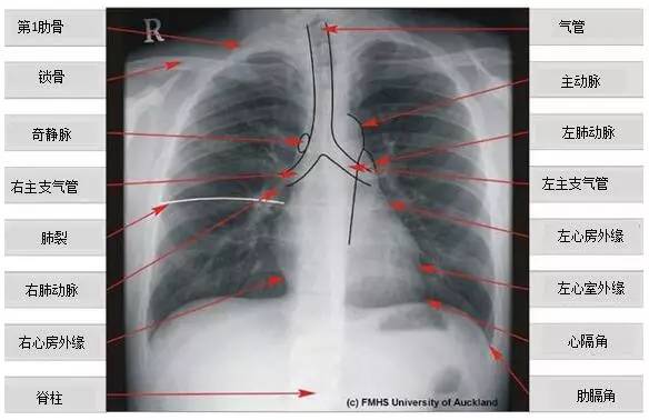 6步法从胸片进行胸部评估