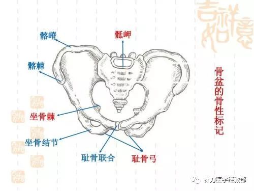 第3～4支针刀松解右侧第三腰椎横突尖与髂嵴中后部臀上皮神经的入臀点