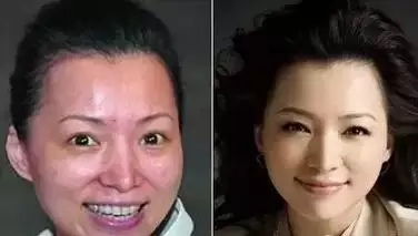 女人做美容对脸好不好