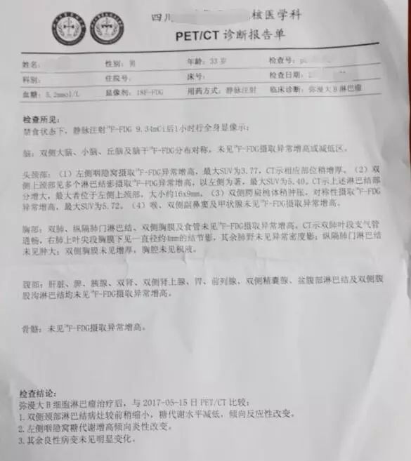 "抗癌第一时间的选择最关键"——弥漫大b淋巴瘤患者经