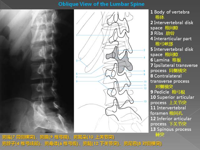 推荐| 详细的腰椎x线解剖及解读