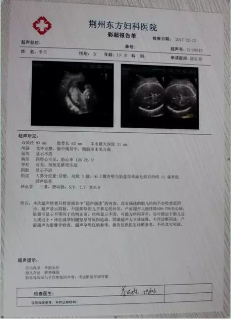 彩超检查报告单? 妇产科