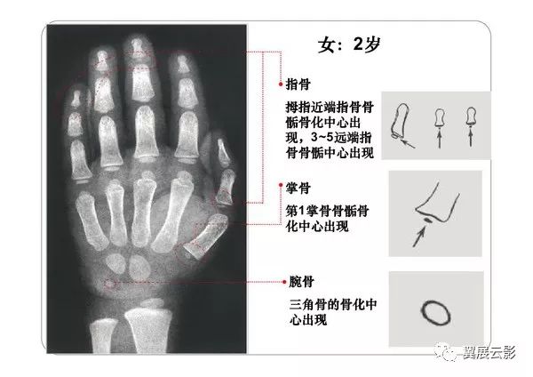 x线机的球管中心正对第三掌骨头.