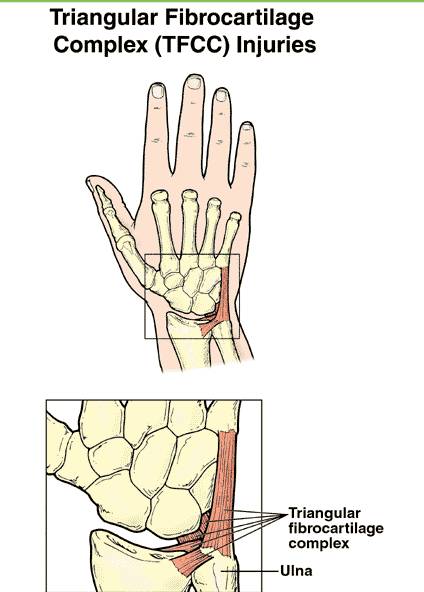 爱护手腕,为时不晚