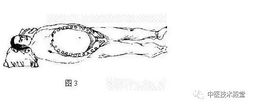 第四图,用两手中间三指从心窝部向下直推至耻骨处二十一次.(图4)
