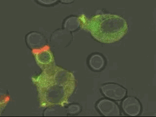 电子显微镜下的吞噬细胞(右侧黄色)正在吞噬炭疽杆菌(布氏杆菌也类似)