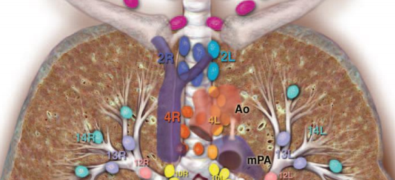图文总结纵隔淋巴结的分区