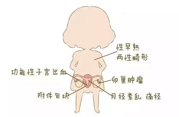 漫画 | 一张"女性妇科疾病"地图，必看!_搜狐健康_搜狐网