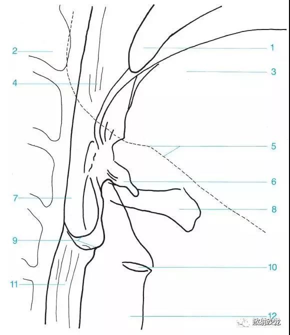 3 vallecula 会厌谷,4 epiglottis 会厌,5 piriform recess 梨状隐窝