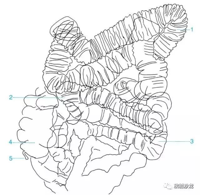 2 pyloric antrum 幽门窦,3 duodenojejunal flexure 十二指肠空肠曲