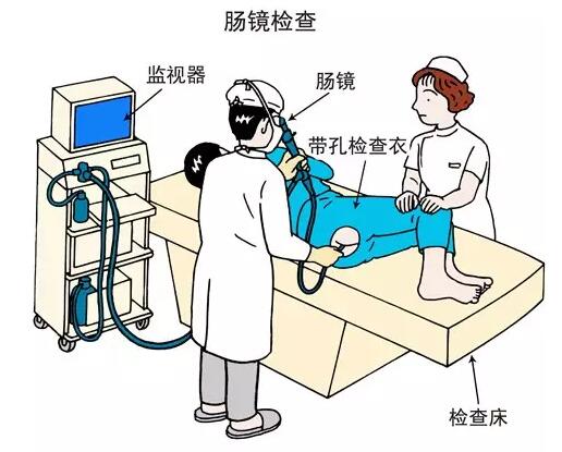 肠镜检查利弊各有多少?