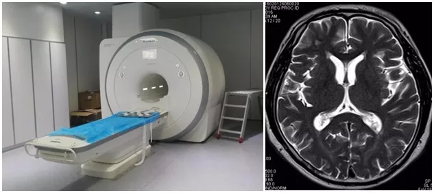 【科普】磁共振(mri)检查—那些你不知道的事