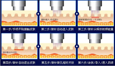 点阵射频的原理是什么_点阵式布局是什么意思(2)