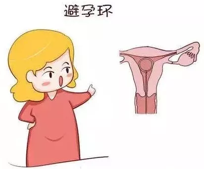 女性取环后,为什么还不怀孕?