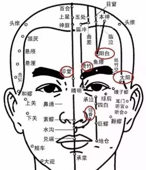 过敏性鼻炎呈发作性鼻痒,流清涕,打喷嚏,可有其他变态反应性疾病病史