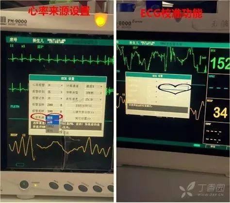 心电监护仪天天用,这10个问题你都弄清楚吗?