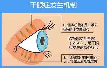 4.手术后出现眩光