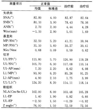 表1 患者治疗前后头影测量结果对比