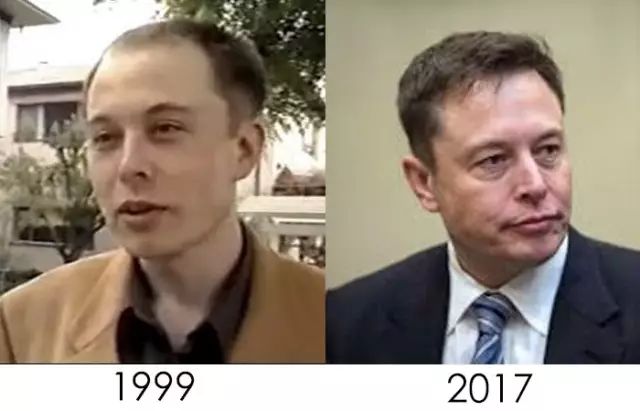 为什么elon musk 的头发逆生长?