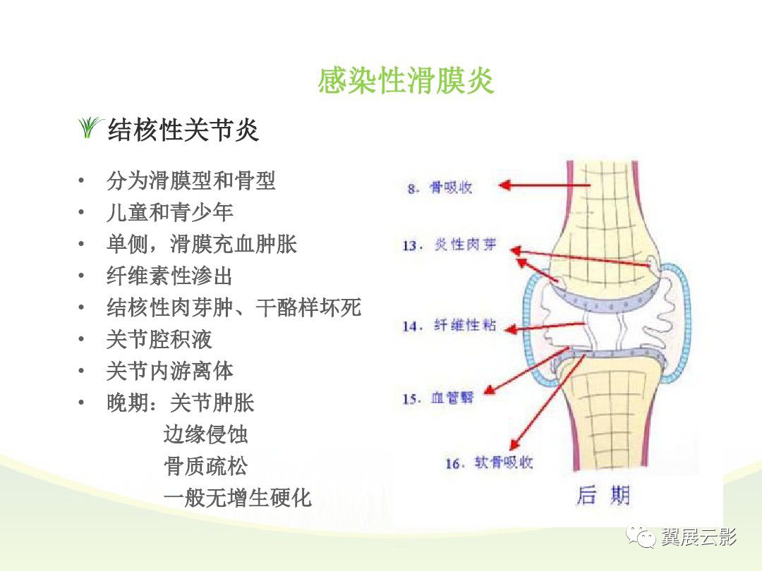 膝关节滑膜病变mri表现