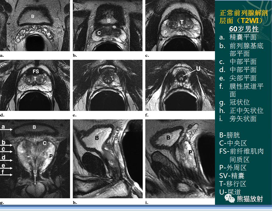 内含:系统解剖,ct断层解剖,前列腺mri解剖,各类示意图(可点击图片