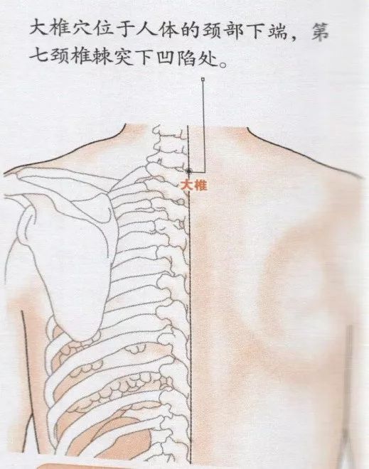 有一个格外突起的颈骨,往下1个凹陷处就是大椎穴