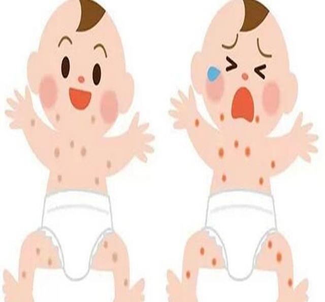 关于宝宝湿疹,99%的新手妈妈都做错了!