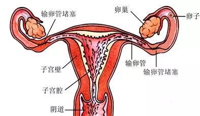 导致不少的女性朋友一直不能如愿的怀上宝宝, 女性输卵管出现堵塞