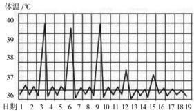 图3 间歇热回归热:体温急剧上升至39℃或以上,持续数天后又骤然下降至
