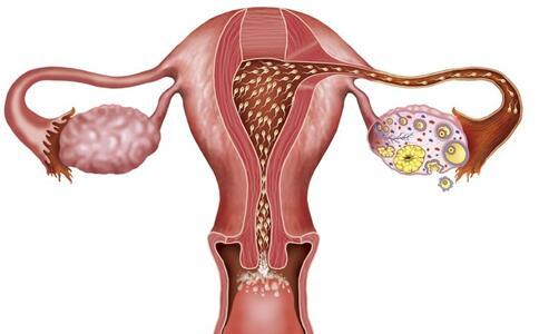 身体异常6大信号 小心卵巢疾病来袭