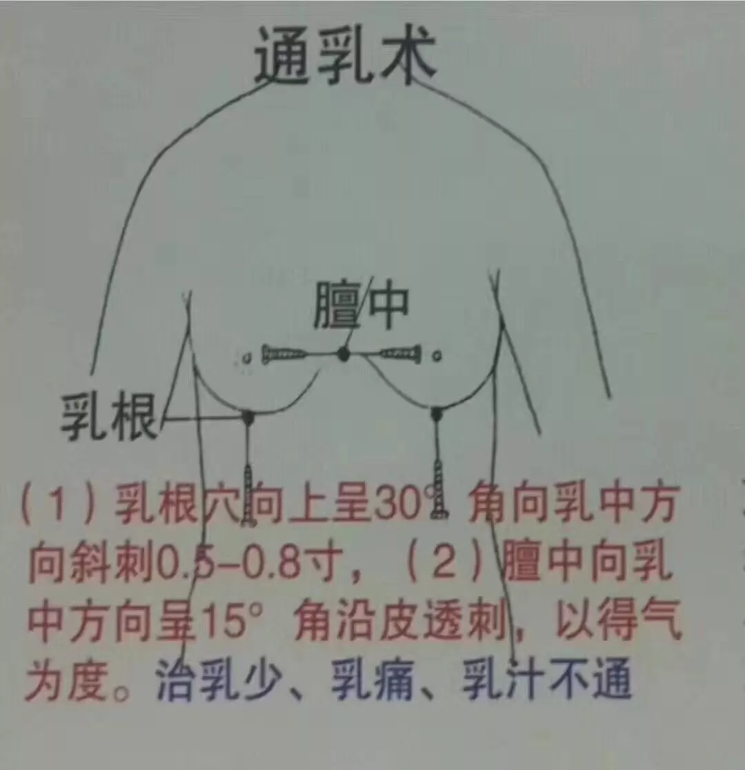 各种刺法没有文字只有图看图学针灸