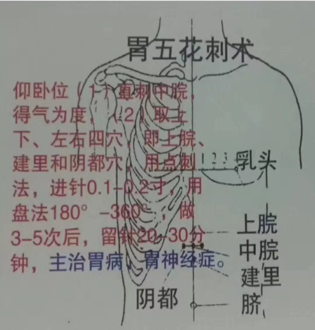 各种刺法(没有文字只有图)看图学针灸