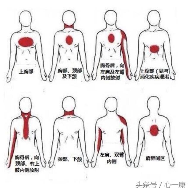 遇上"假心绞痛"怎么办?别担心,其实你根本没有心脏病!