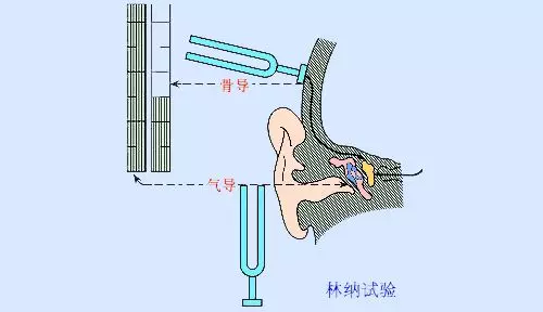 听力检测之音叉试验