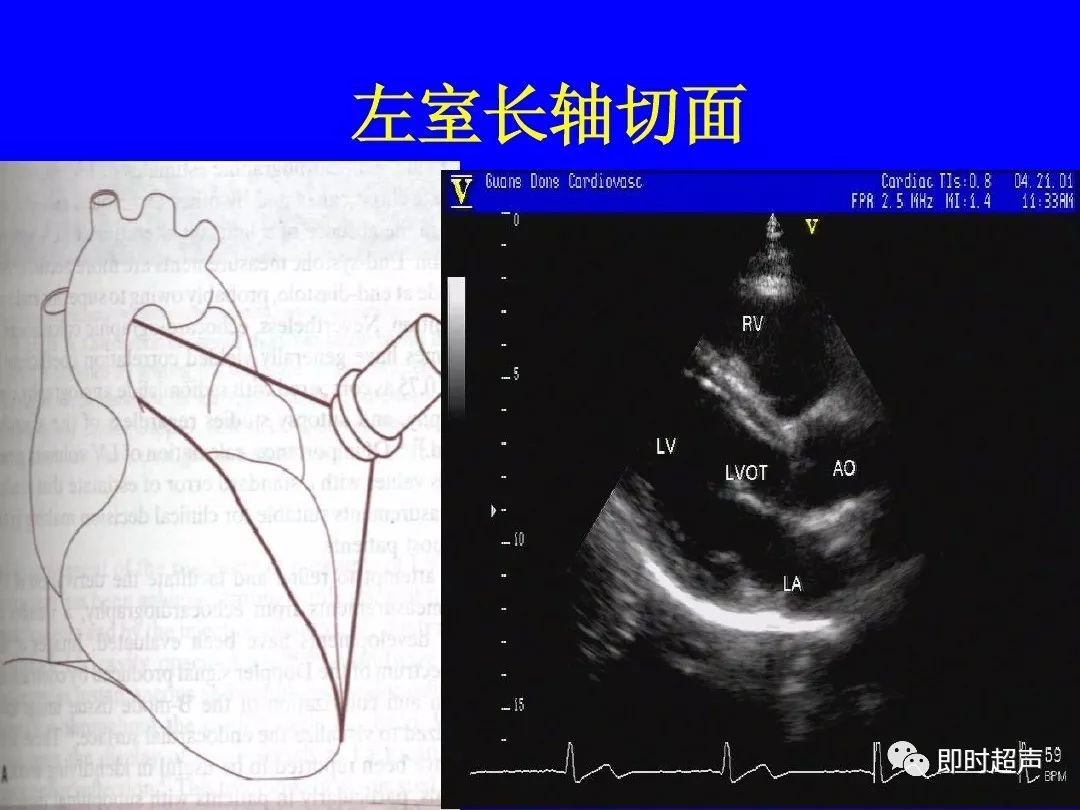 心脏超声标准切面及测量