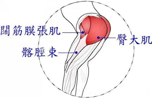 针刀专家许振南教授阔筋膜张肌与髂胫束的针刀临床应用