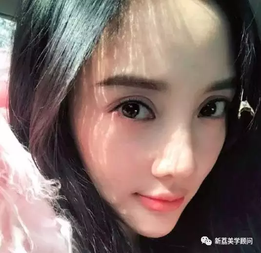 双眼皮 || "一次就好,二次苦恼",细述你的双眼皮为什么不好?