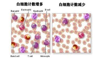 白细胞减少