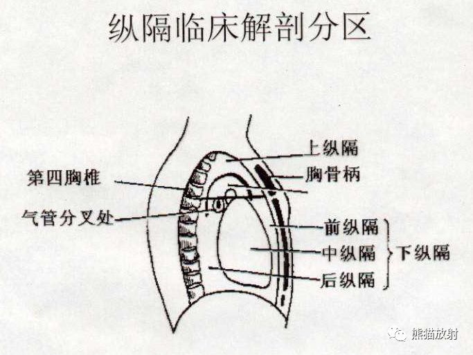 纵隔解剖纵隔疾病x线诊断要点