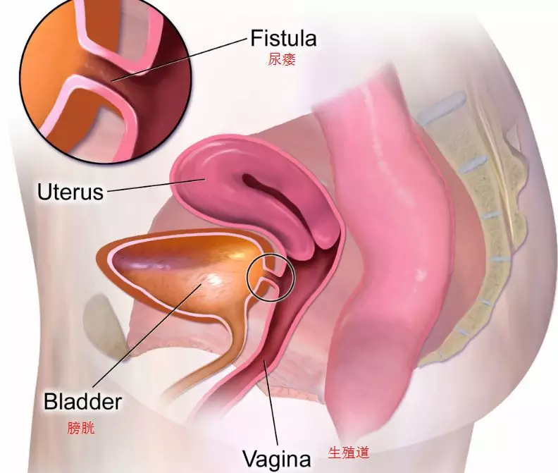 口人口手的口_人口普查