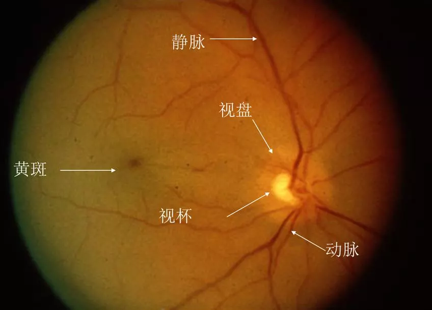 "三年来,每一天我都努力练习我的右眼,但至今我还不能控制它对焦到想